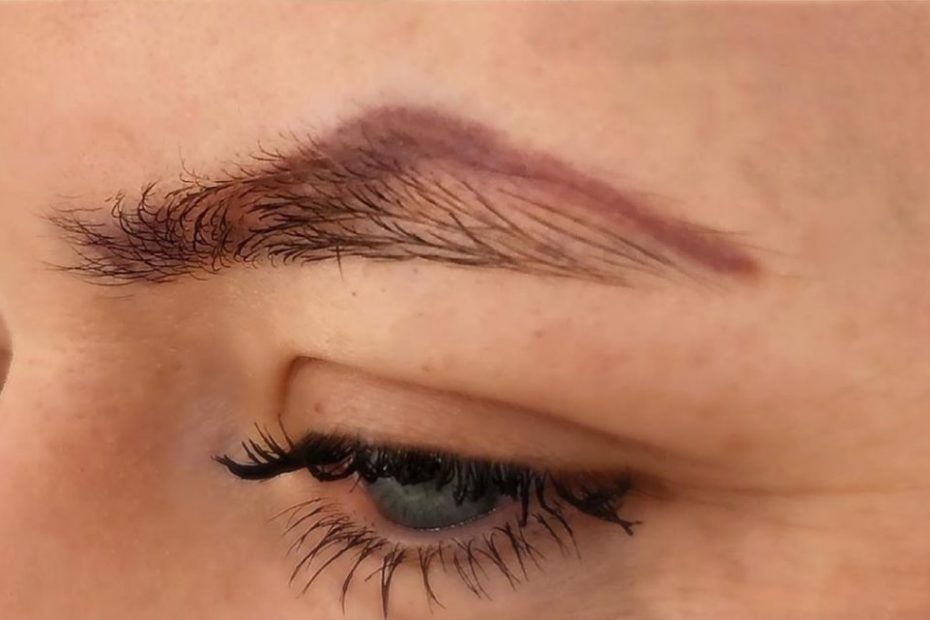 eyebrow tattoo removal