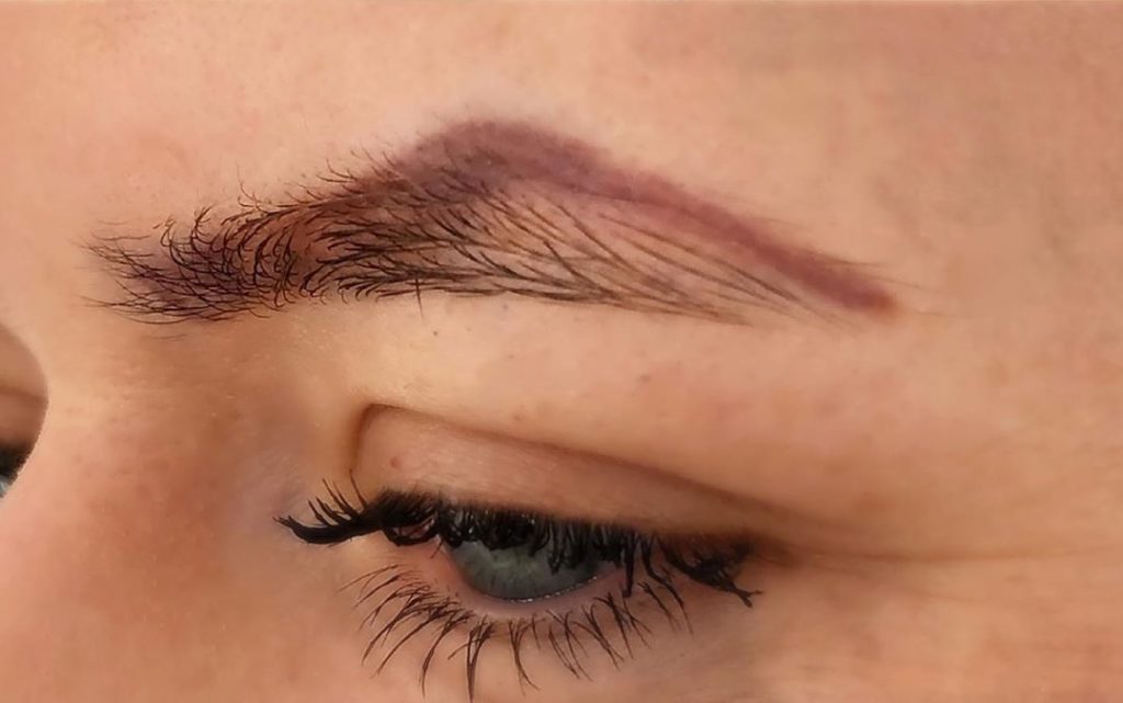 Saline Eyebrow Tattoo Removal Before and After When Is It Better